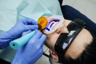 How to get the best cosmetic dental treatments for yourself easily